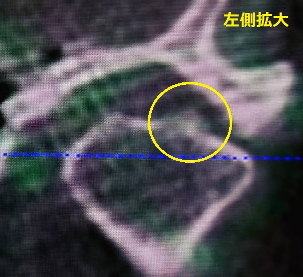 前頭断面拡大写真